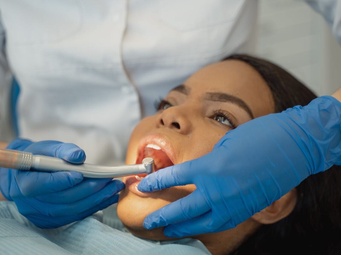 Scaling dentale: procedure e benefici per una salute orale ottimale