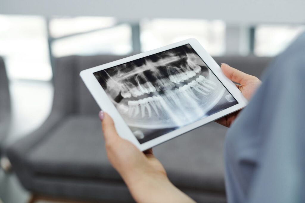 Tomografia computerizzata dentale: guida completa e applicazioni