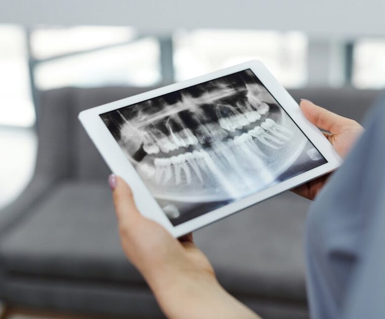 Tomografia computerizzata dentale: guida completa e applicazioni